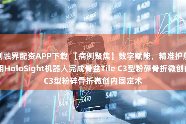 创融界配资APP下载 【病例聚焦】数字赋能，精准护航 医院应用HoloSight机器人完成骨盆Tile C3型粉碎骨折微创内固定术